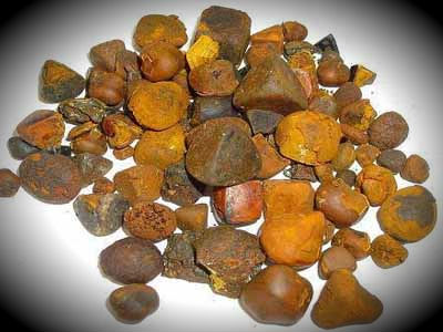 Камни в печени или желчные камни